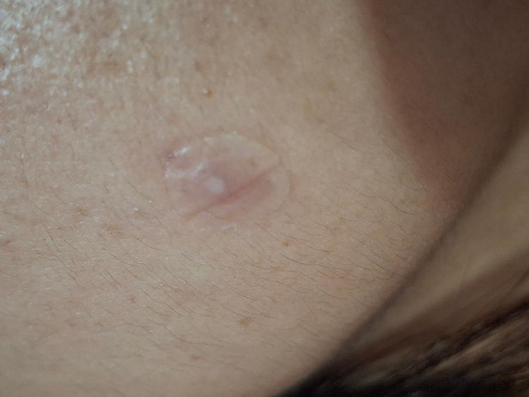 Sumak Skin