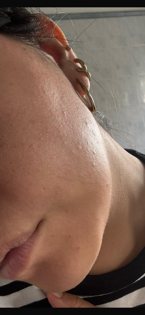 Sumak Skin