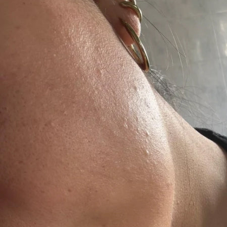 Sumak Skin