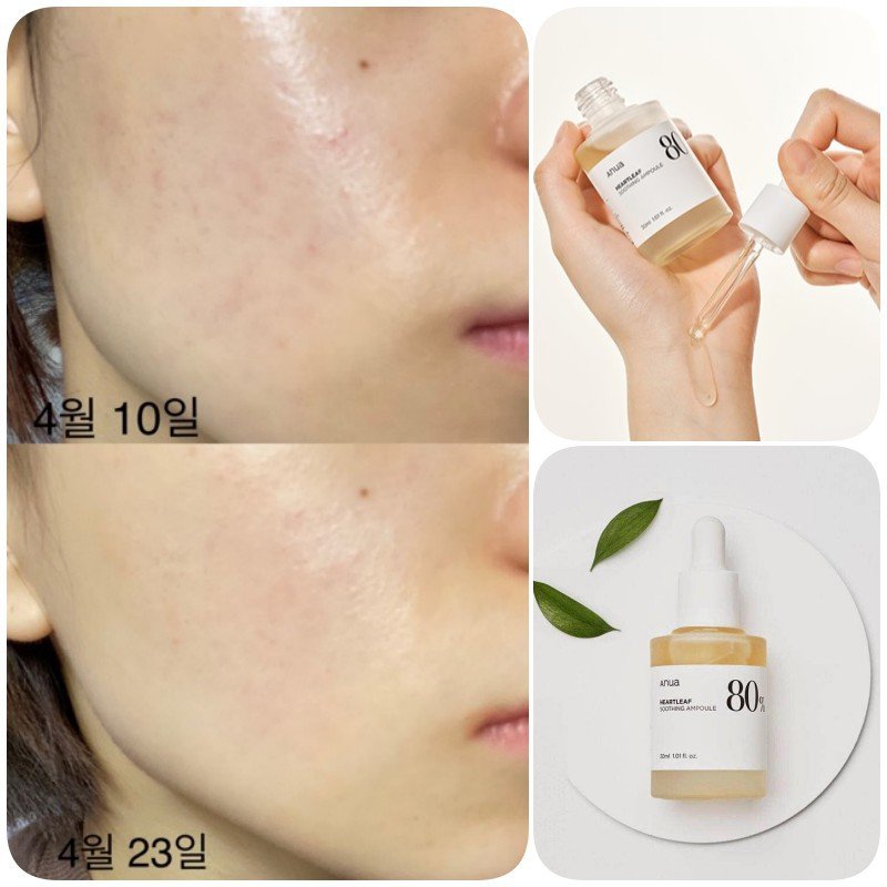 ANUA - Heartleaf 80% Moisture Soothing Ampoule 30ml